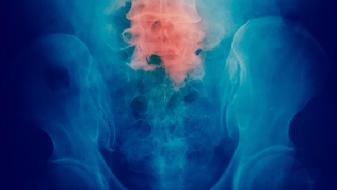 台湾疫情严重疫苗紧缺，新增472例本土病例如何防控？